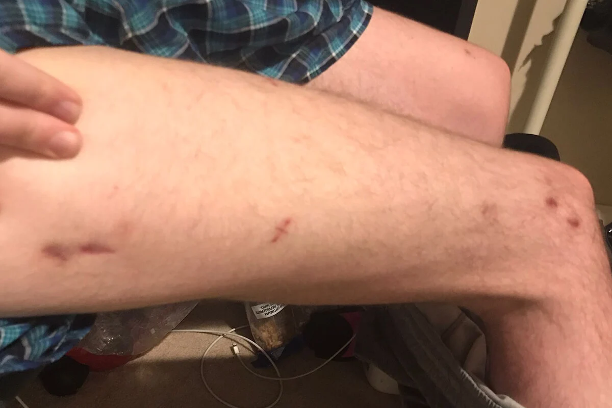 scar 7